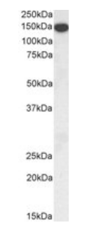Thrombospondin Antibody