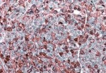 NFATC2/NFAT1 Antibody