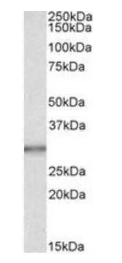 CA1 Antibody