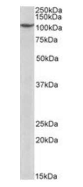 PRPF6 Antibody