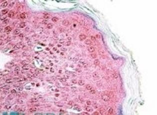 TRIM29/ATDC Antibody