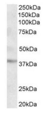 MICS1/GHITM (aa117-127) Antibody