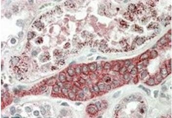 DCUN1D1 Antibody