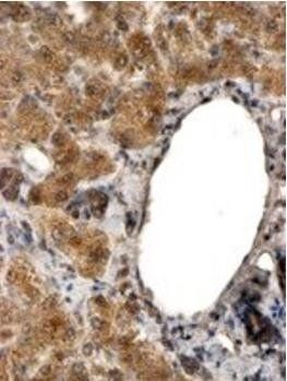 ALDH3A2 Antibody