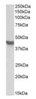 SLC2A4/GLUT4 Antibody