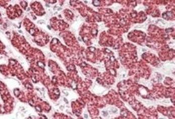 ETFB/FP585 (aa 152-165) Antibody