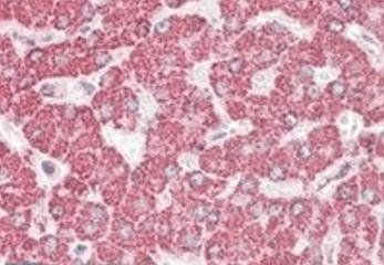 ETFB (aa 231-243) Antibody