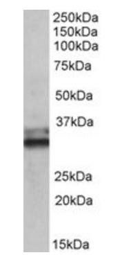 ETFA (aa139-152) Antibody