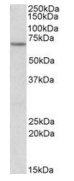 ETFDH Antibody