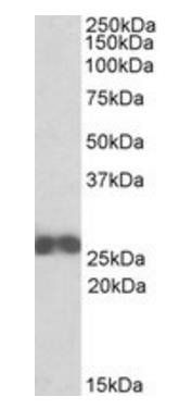 ARHGDIB Antibody