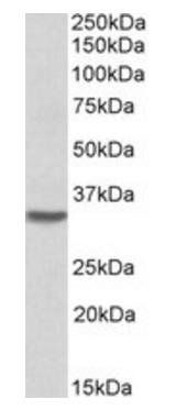 HOXC8 Antibody