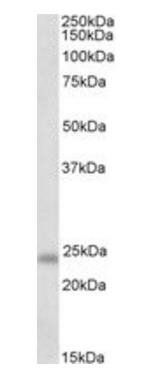 GM2A (aa 179-189) Antibody