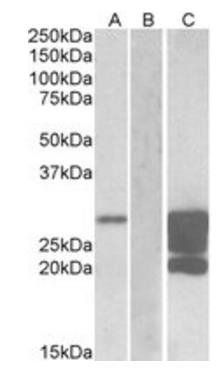 GM2A (aa 179-189) Antibody
