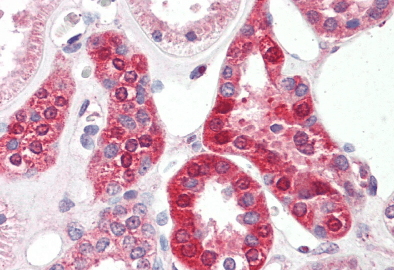 Creatine transporter 1/SLC6A8 Antibody