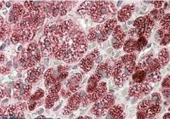 Goat anti-CYB5R3 / Dia 1 Antibody