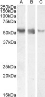 RORC (aa200-212) Antibody