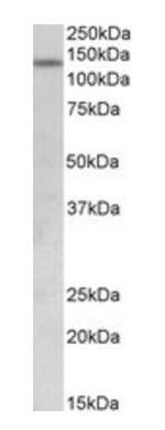 KDM2A (aa445-459) Antibody