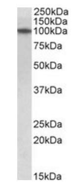 Goat anti-TXNDC11 (aa113-126) Antibody