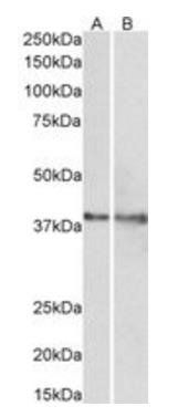 IDH3G (aa337-350) Antibody