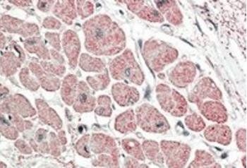 Atrial natriuretic factor Antibody