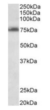 Goat anti-TSPYL2 (aa441-454) Antibody