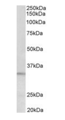 PI15 (aa128-141) Antibody
