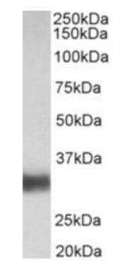 SFTPA1/SFTPA2 (aa102-115) Antibody