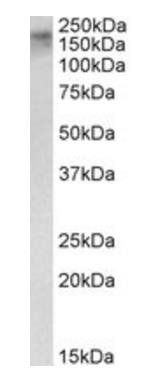 ERCC6 (aa717-731) Antibody