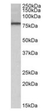 DYRK1A Antibody