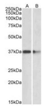 PRMT2 Antibody