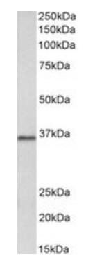 PRMT2 Antibody