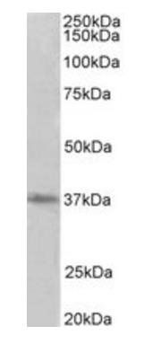 PRMT2 Antibody