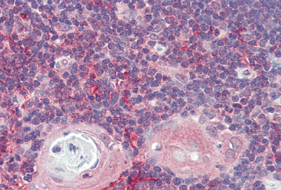 ARF4 (aa137-150) Antibody