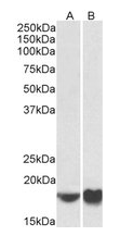 ARF4 (aa137-150) Antibody
