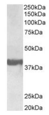 Endophilin-A1/SH3GL2 Antibody