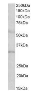 Goat anti-IGFBP1 (aa156-170) Antibody