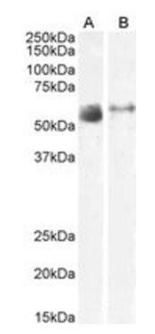 Goat anti-SLC7A7 / y+LAT-1 Antibody