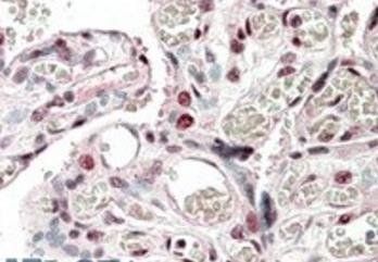 Goat anti-CREB3L2 Antibody