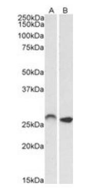 HOXC6 (isoform 1) Antibody