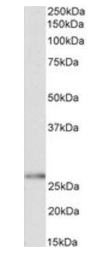 HOXC6 (isoform 1) Antibody