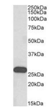 HOXC6 (isoform 1) Antibody