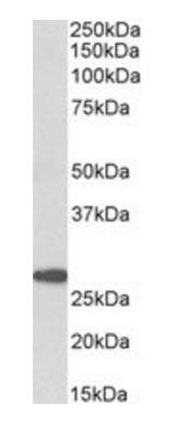 Goat anti-PTGDS Antibody