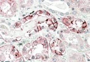 Goat anti-carbonic anhydrase XII (aa188-199) Antibody