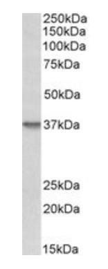 syndecan 1/CD138 Antibody