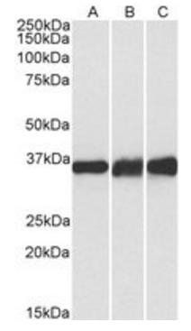 LDHB Antibody