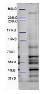 Alfy/WDFY3 Antibody