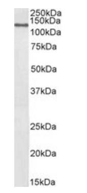 CCAR2/DBC1 (aa842-855) Antibody