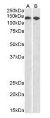 CCAR2/DBC1 (aa842-855) Antibody