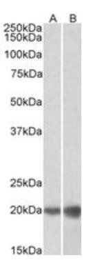 dUTPase/DUT Antibody