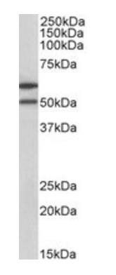 Goat anti-IL13RA2 (aa96-107) Antibody